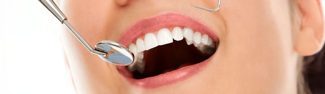 A close up of a person getting a dental checkup.